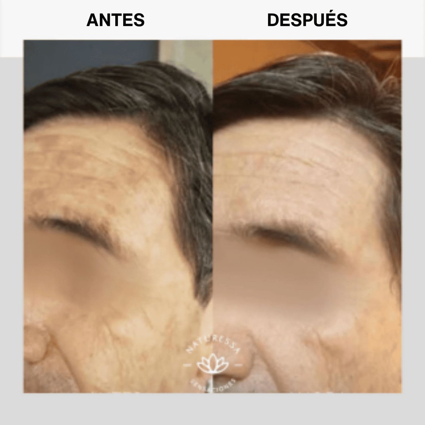 Crema Regenerativa MEN